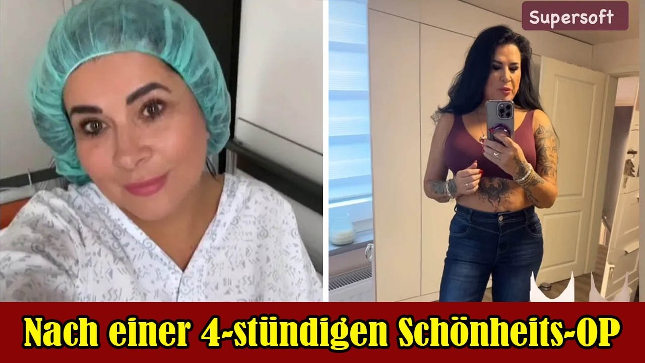 Umstyling 😍 Iris Klein: Nach einer 4-st&uuml;ndigen Sch&ouml;nheitsoperation
