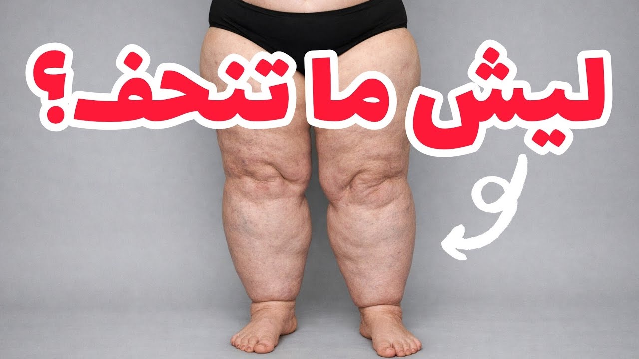 مو كل دهون… وذمة شحمية؟ علامات وحلول لازم تعرفيها