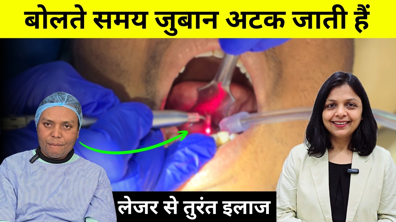 बोलते समय अटकते हैं?  Tongue Tie Laser Surgery se Turant Relief
