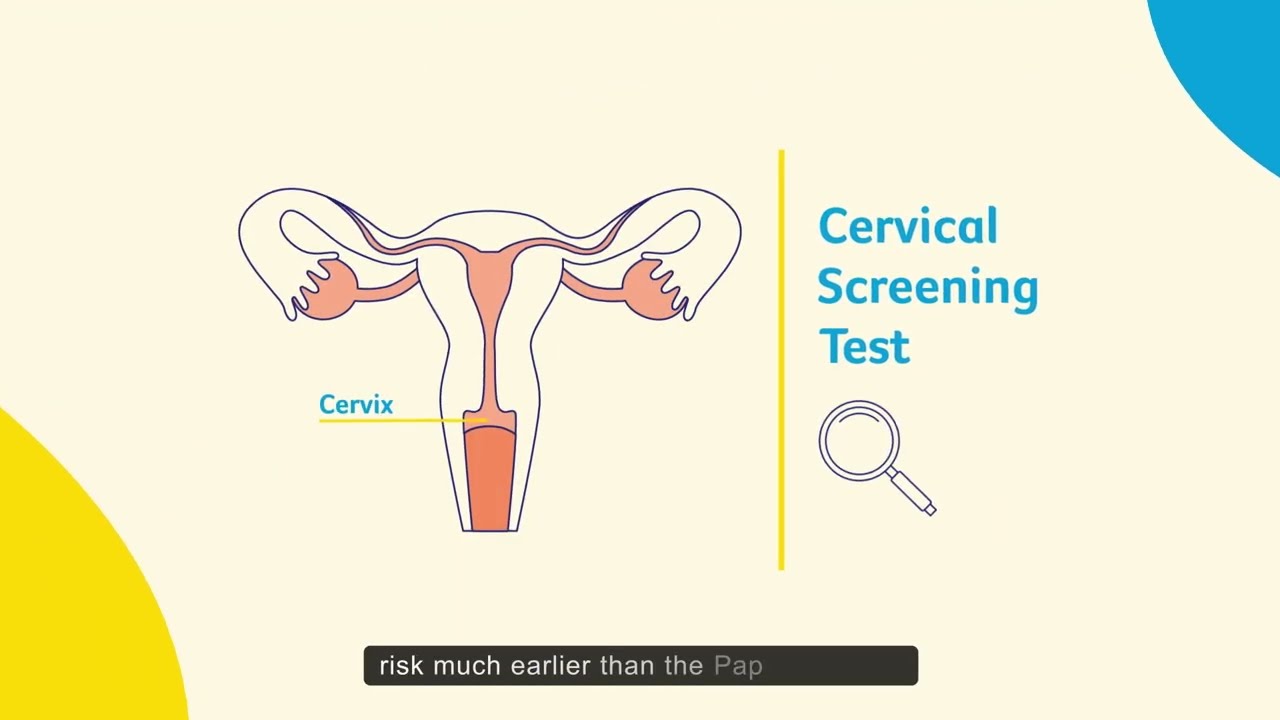 Understanding your Cervical Screening Test result