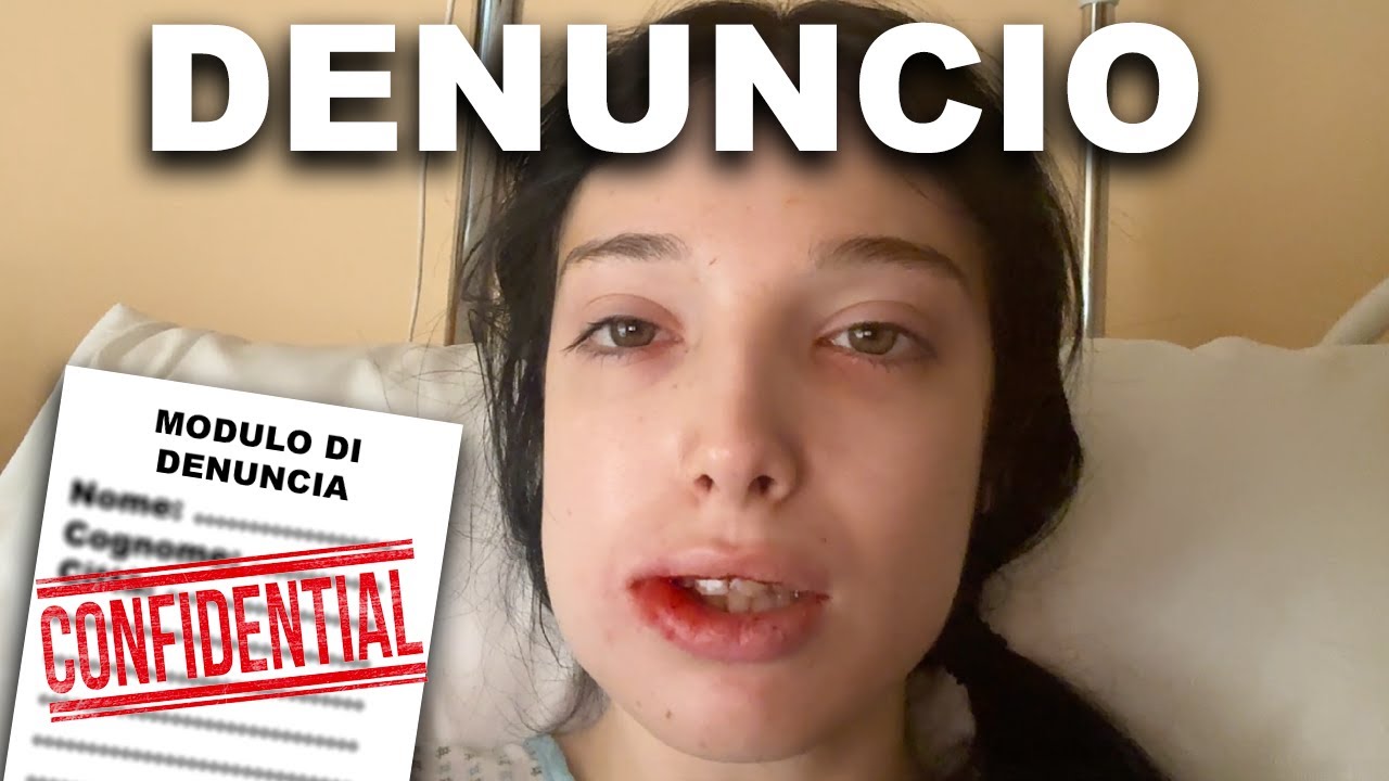 DENUNCIO IL DENTISTA CHE MI HA ROVINATO