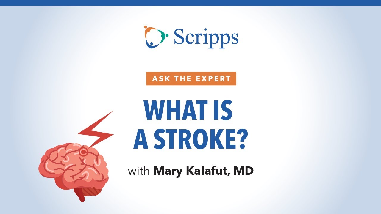 Stroke Causes and Risk Factors | Ask The Expert