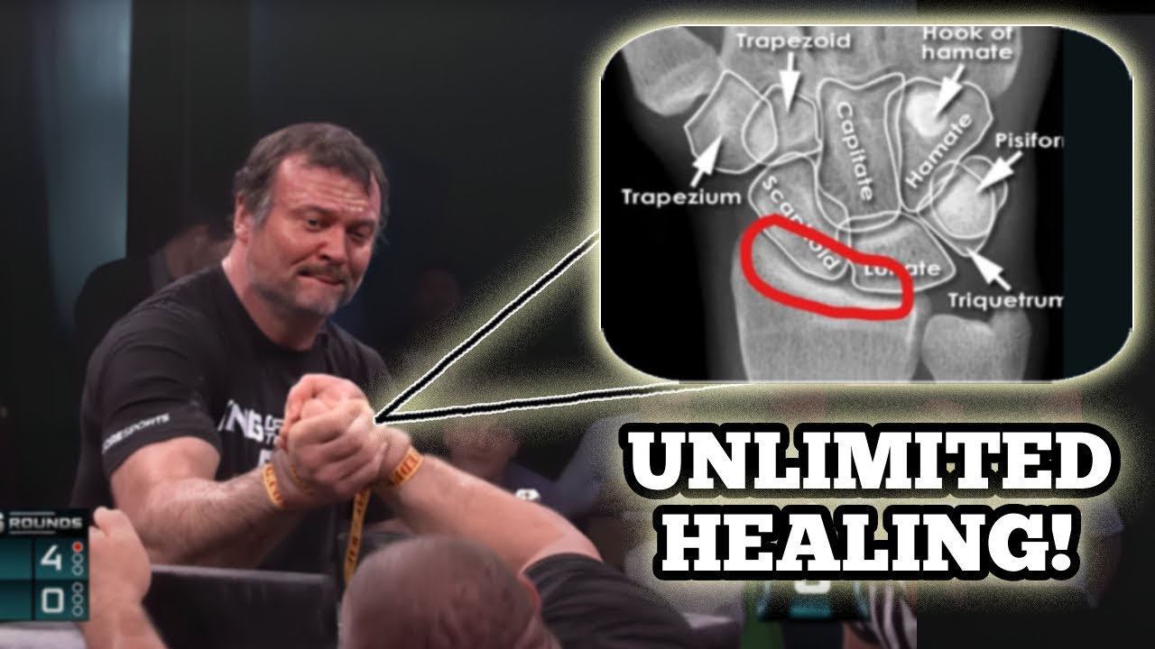 How Devon Larratt's Arm Injuries Heal So Fast?