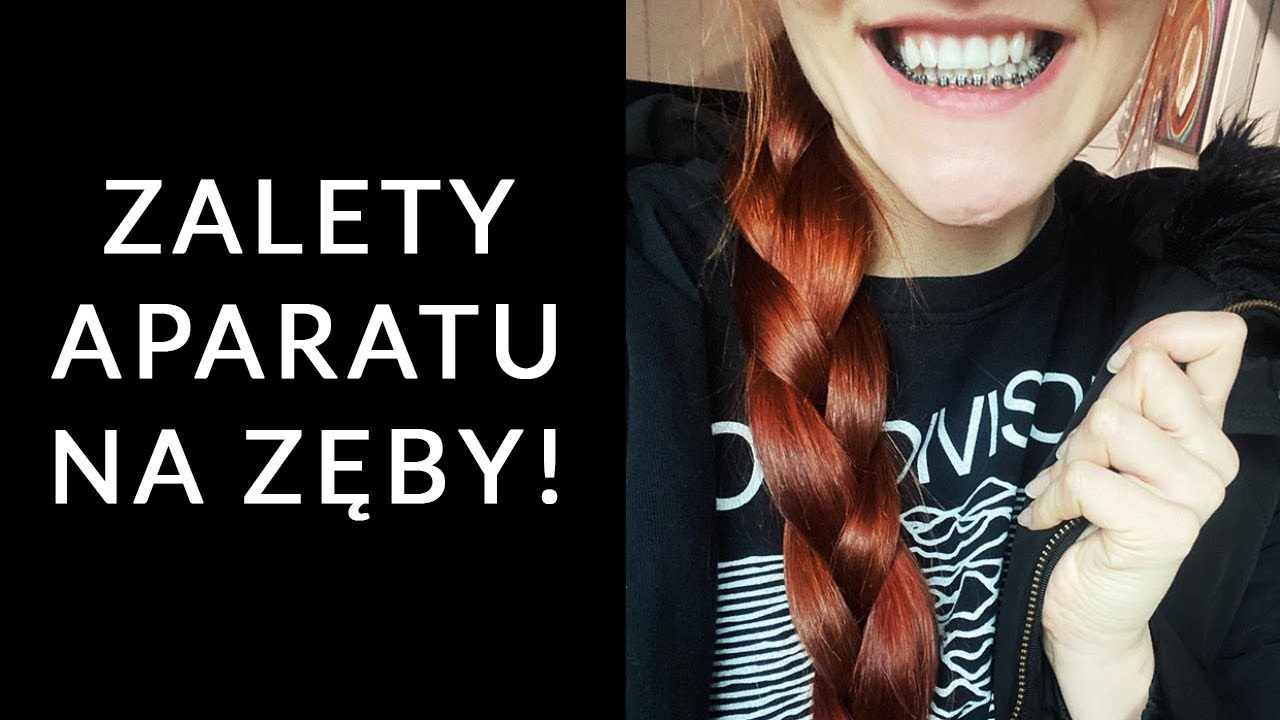 ZALETY APARATU NA ZĘBY
