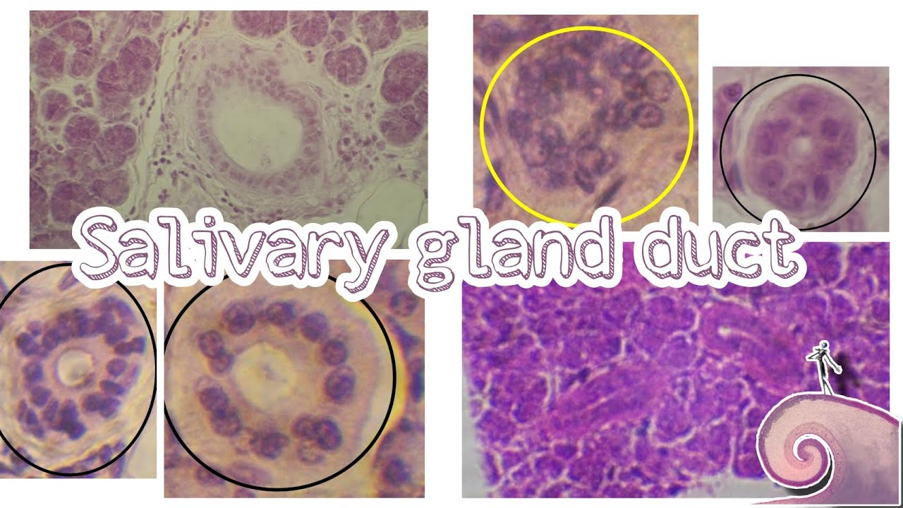 salivary gland duct types | histo slide