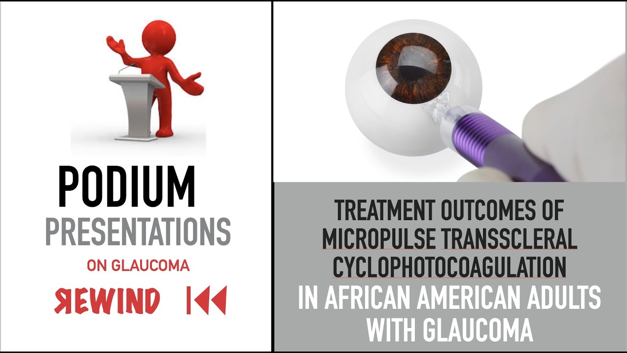 Micropulse Cyclophotocoagulation Explained: Where  It Fits in Glaucoma Care