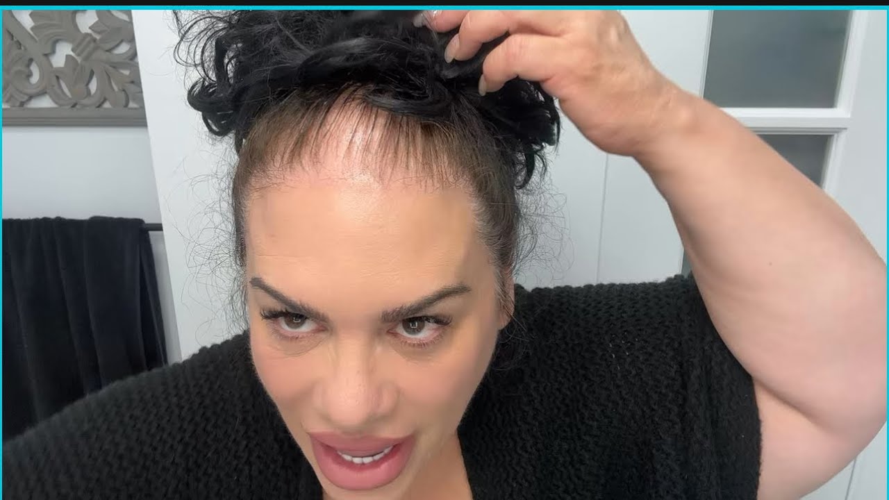 How I covered this thinning hair