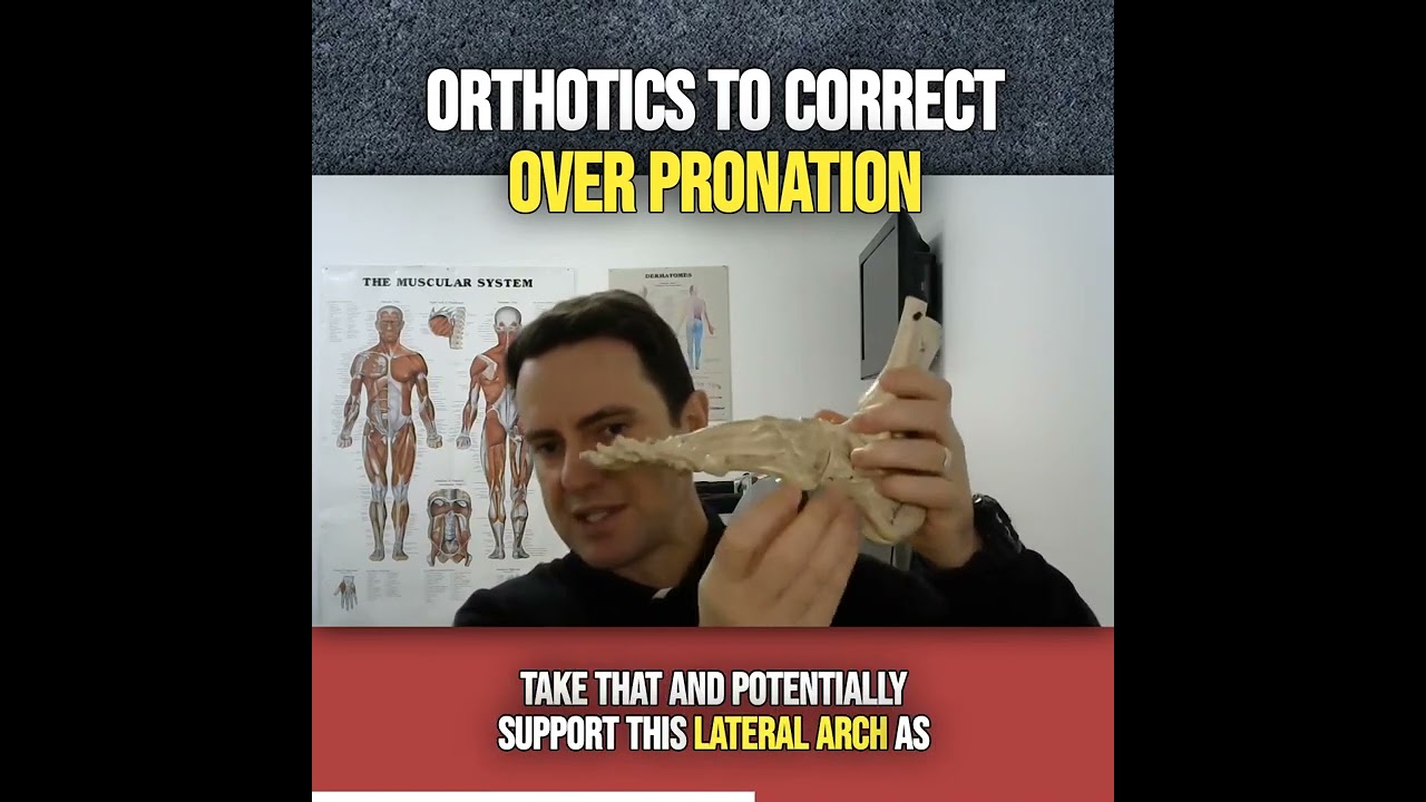 Best orthotic insoles for Overpronation