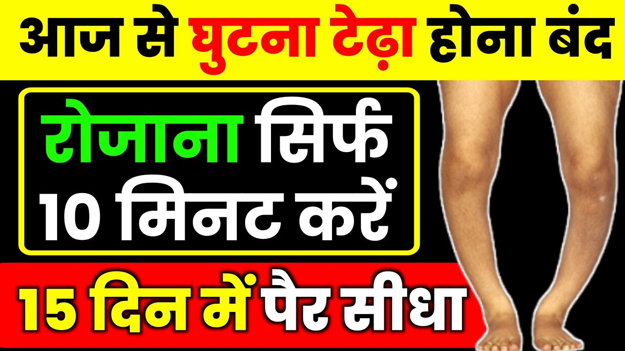 घुटने का गैप और टेढ़ापन का इलाज बिना सर्जरी|Knee Pain Exercises|Bow Leg Correction Exercises