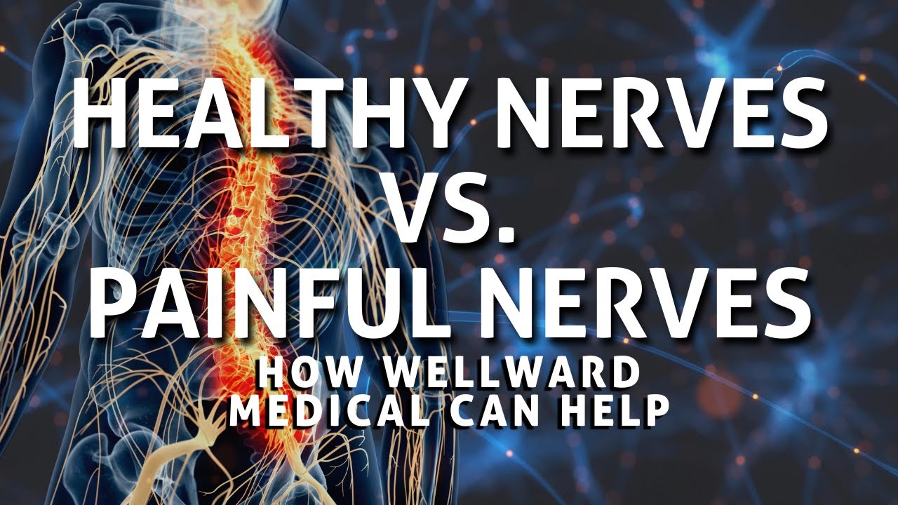 Healthy Nerves vs. Painful Nerves &ndash; How Wellward Medical Can Help