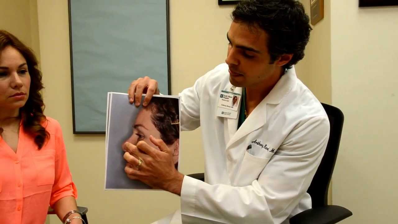 Female Rib Revision Rhinoplasty in Miami | Anthony Bared, MD, FACS Miami, FL