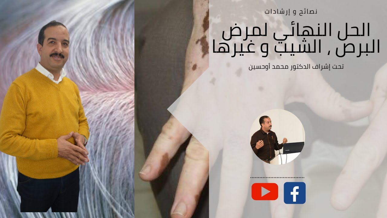 اطعمة تساعد على افراز الميلانين و تعالج امراض البرص و الشيب و كل الامراض المشابهة