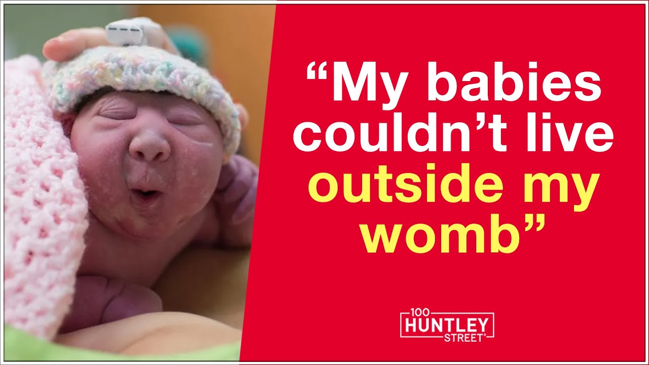 Why I didn’t Abort My Babies with Anencephaly