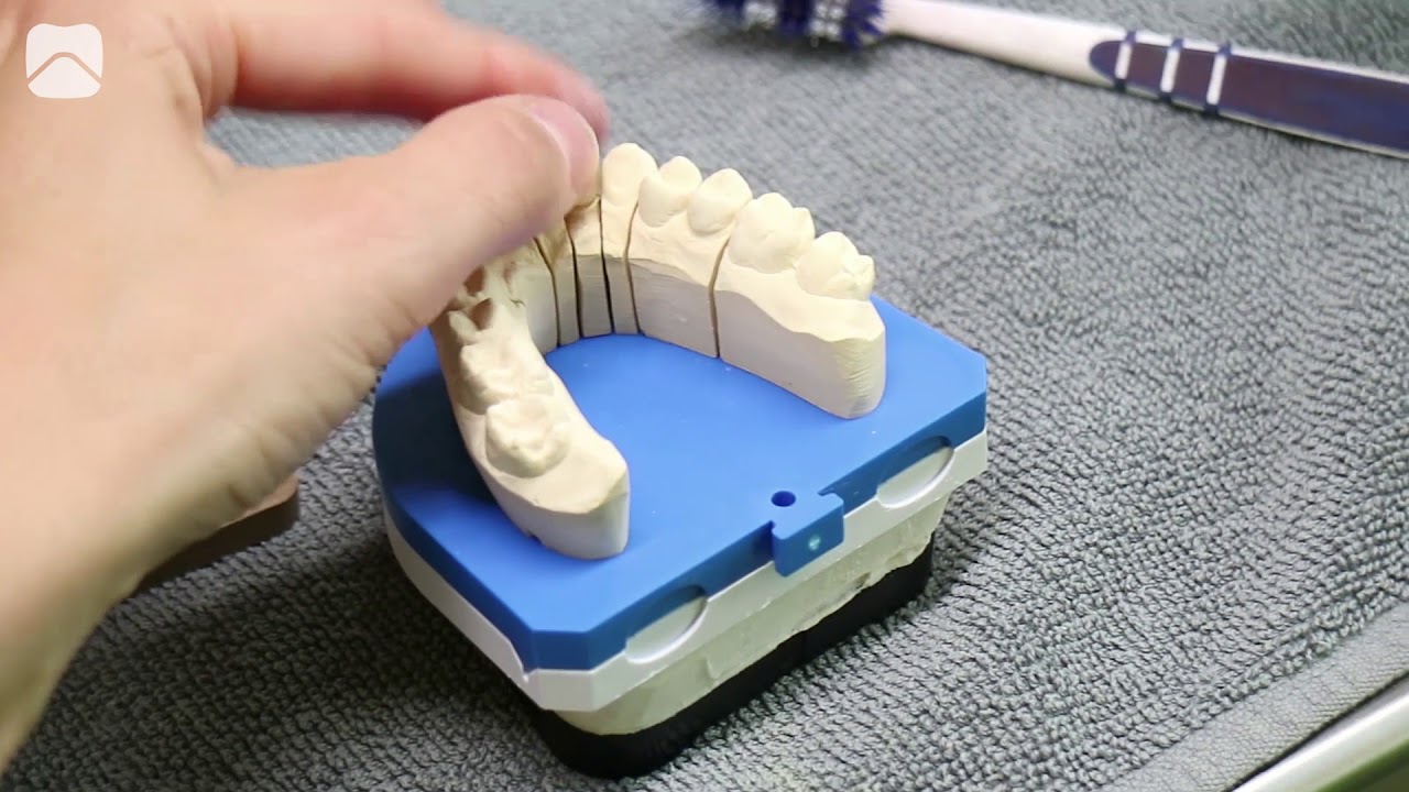 Vom Zahnarztbesuch bis zur fertigen Krone: Ein Blick hinter die Kulissen bei Flemming Dental