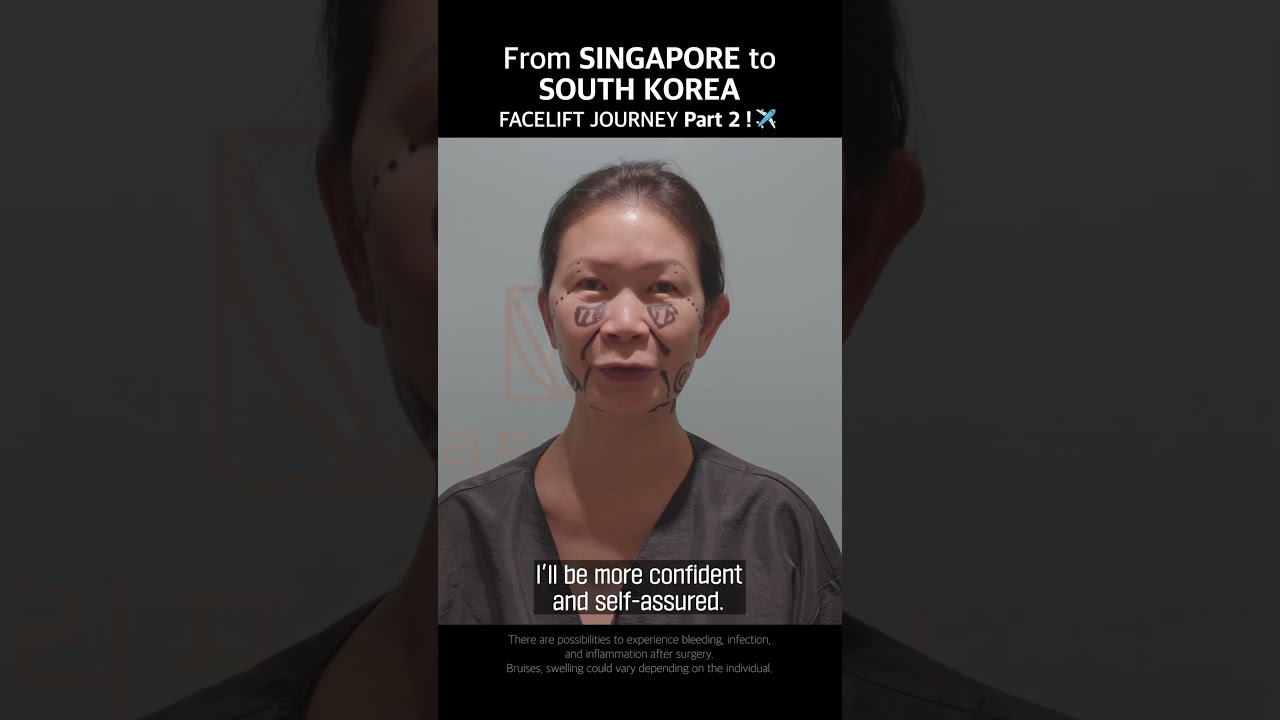 From SINGAPORE to SOUTH KOREA FACELIFT JOURNEY! part 2