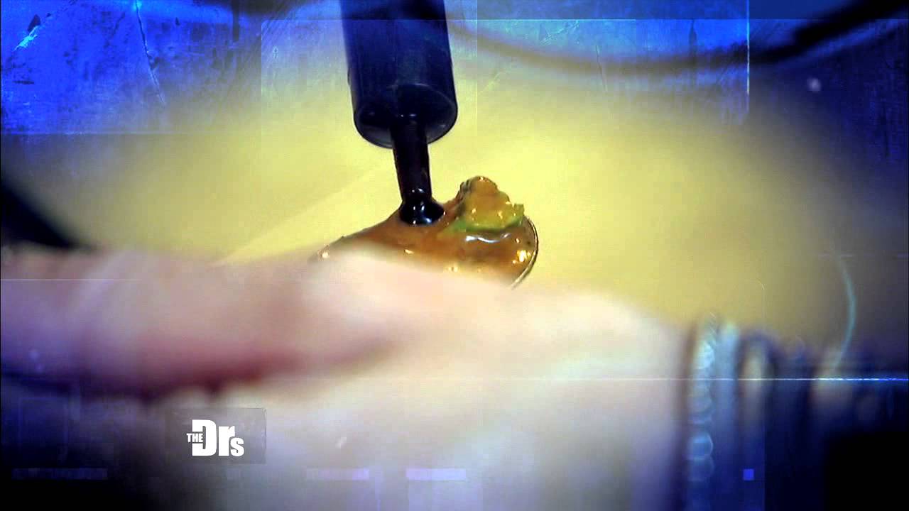 Wednesday 03/26: Unbelievable Nose Makeover; Medical Marijuana for Kids - Show Promo