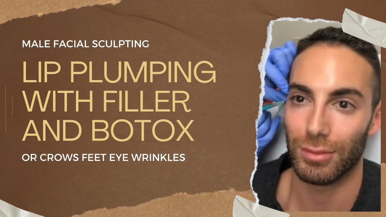 MALE FACIAL SCULPTING: LIP PLUMPING WITH FILLER AND BOTOX FOR CROWS FEET EYE WRINKLES |DR JASON EMER