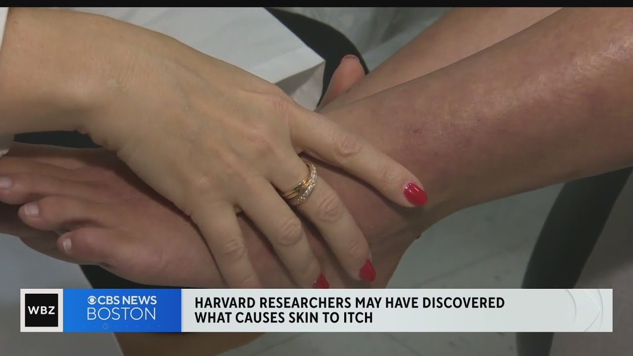 Researchers may have found what causes eczema itch
