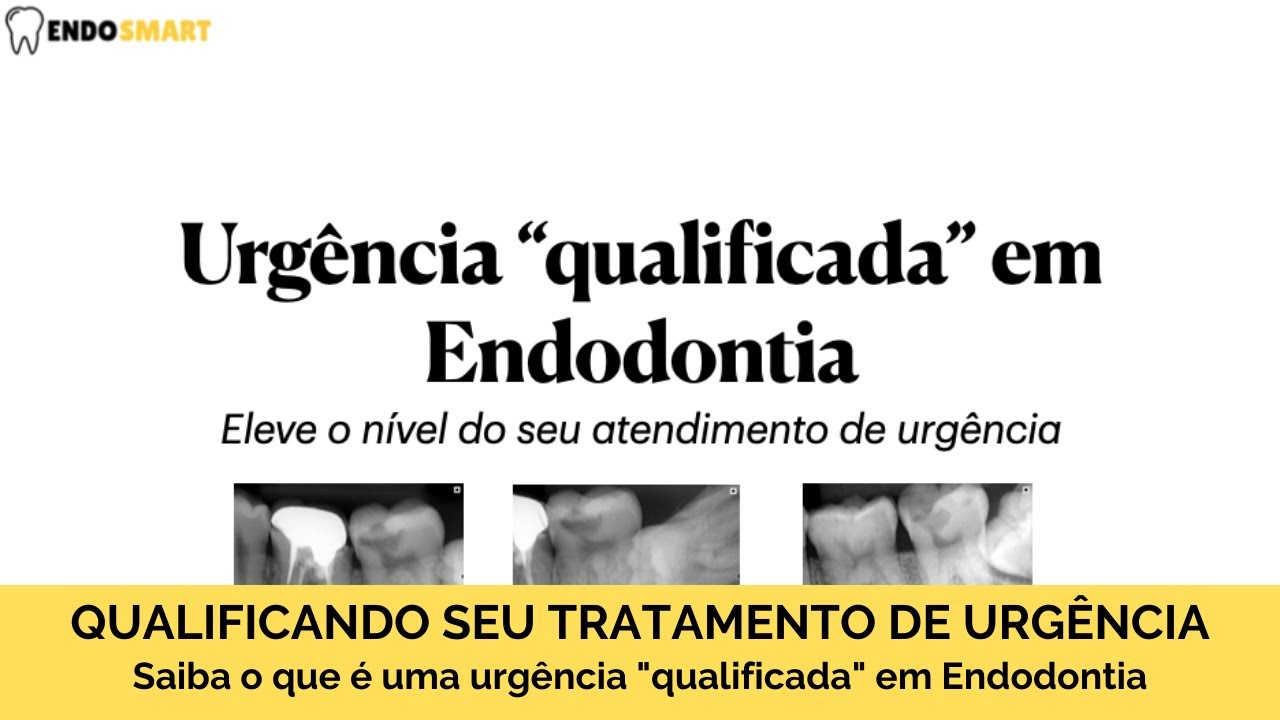 Qualificando o tratamento de urgência em Endodontia