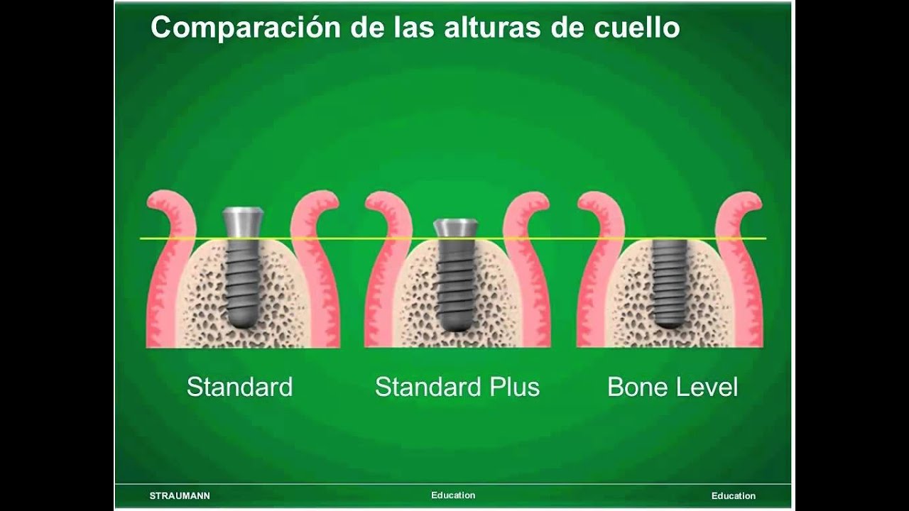 003 Straumann Dental Implant System