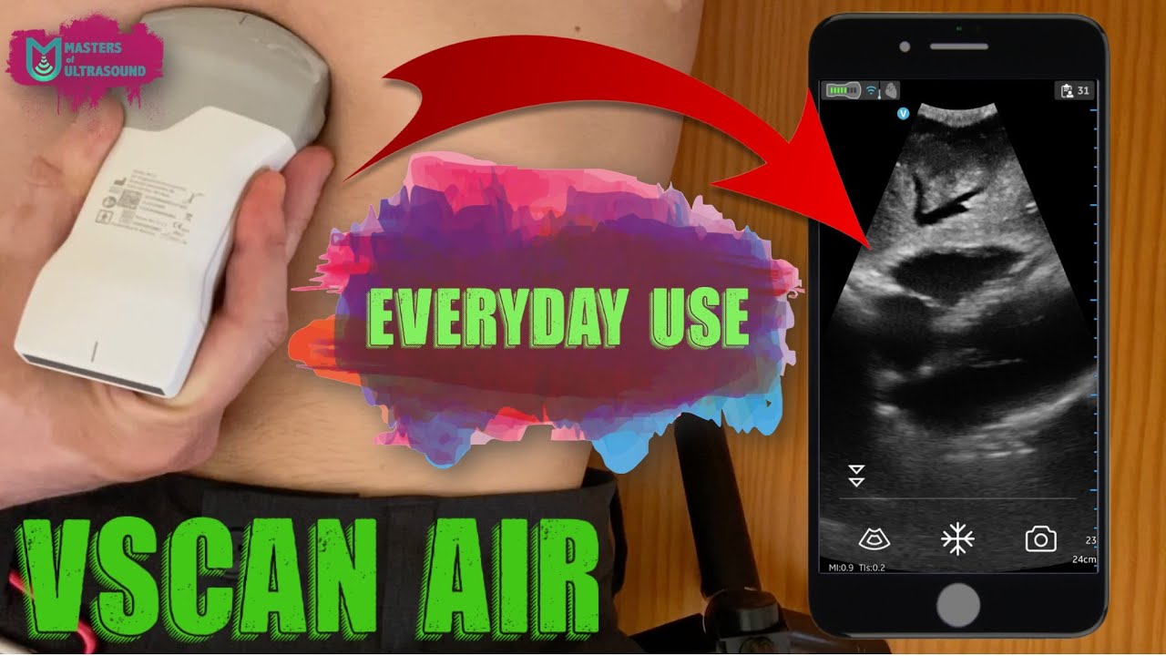 GE Vscan Air image quality test! I Everyday use clips, comparison vs a cart machine and a live demo!