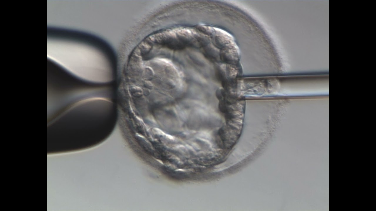 Embrüodiagnostika - NovaVita kliinikus - digiõpik - Viljakusest.ee