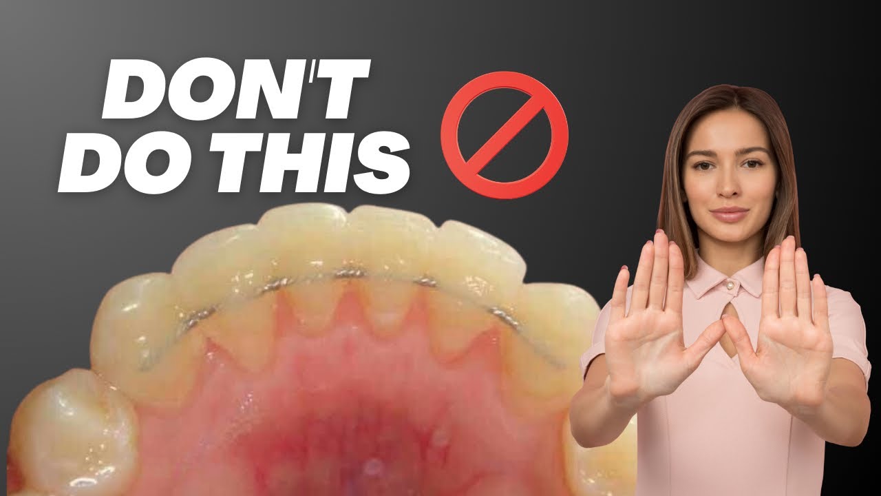 Stop Using the Wrong Wire! 🚫 (Manual vs. Digital Retainers)
