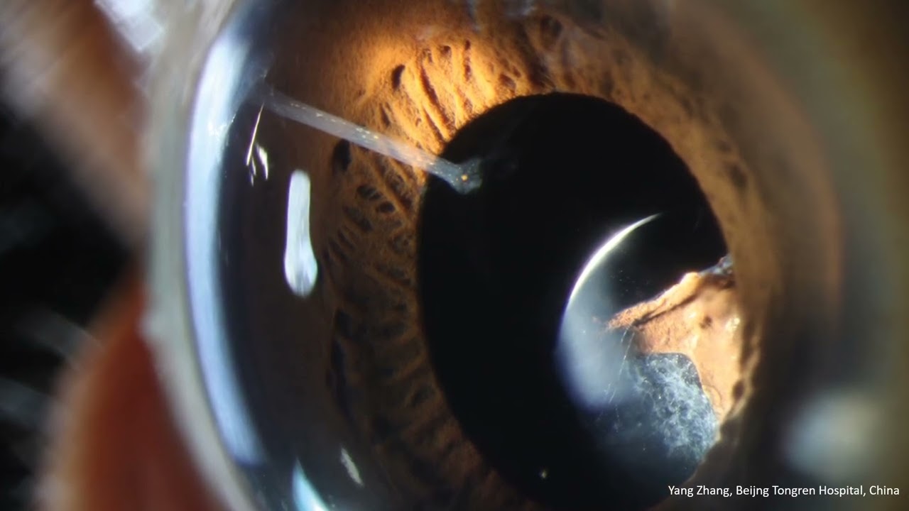 Haag-Streit Slit Lamps
