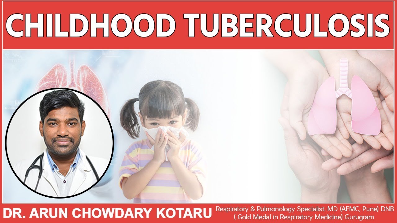 Childhood Tuberculosis || Dr. Arun Chowdary Kotaru