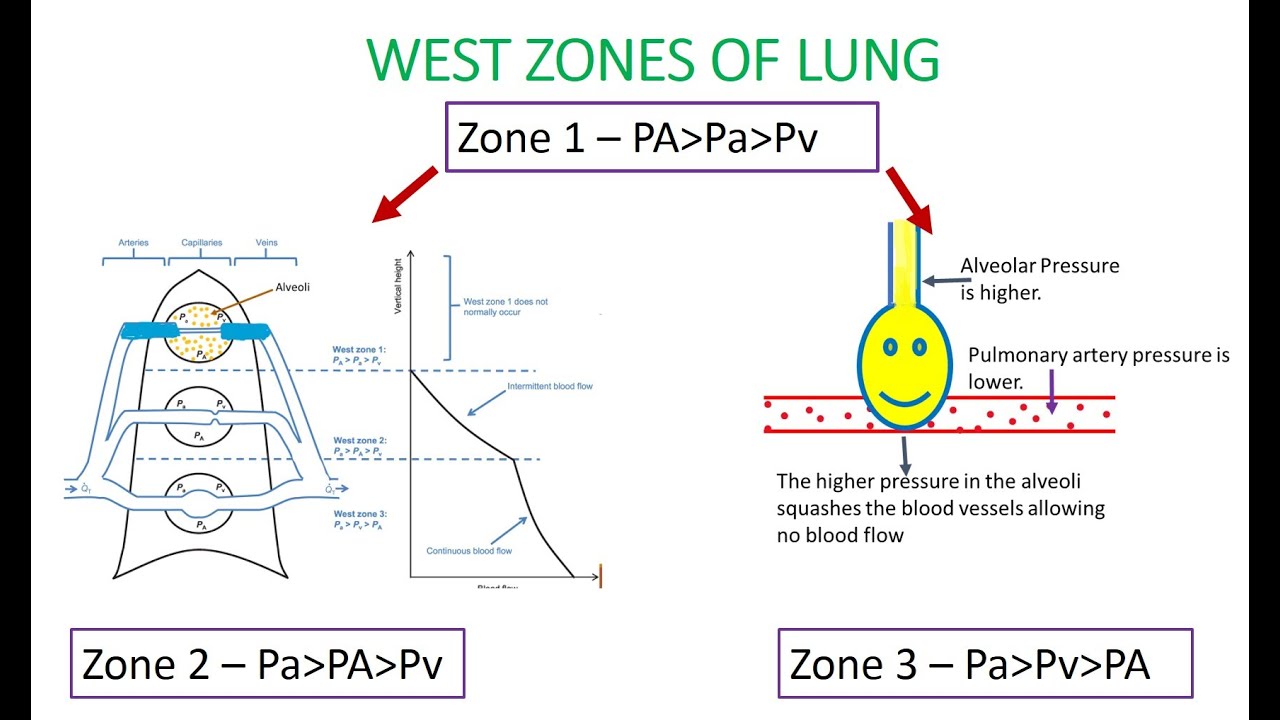 LEARN WEST LUNG ZONES EASILY /Zone 1 Zone 2 Zone 3 in lung/ lung zones anatomy /Highest ventilation.