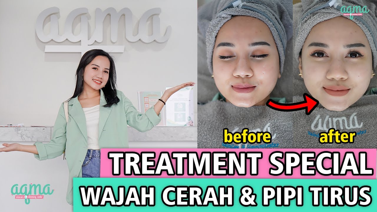 SOLUSI BUAT YANG INGIN PUNYA PIPI TIRUS NIH!! | TREATMENT DI AQMA SKINCARE CIKAMPEK