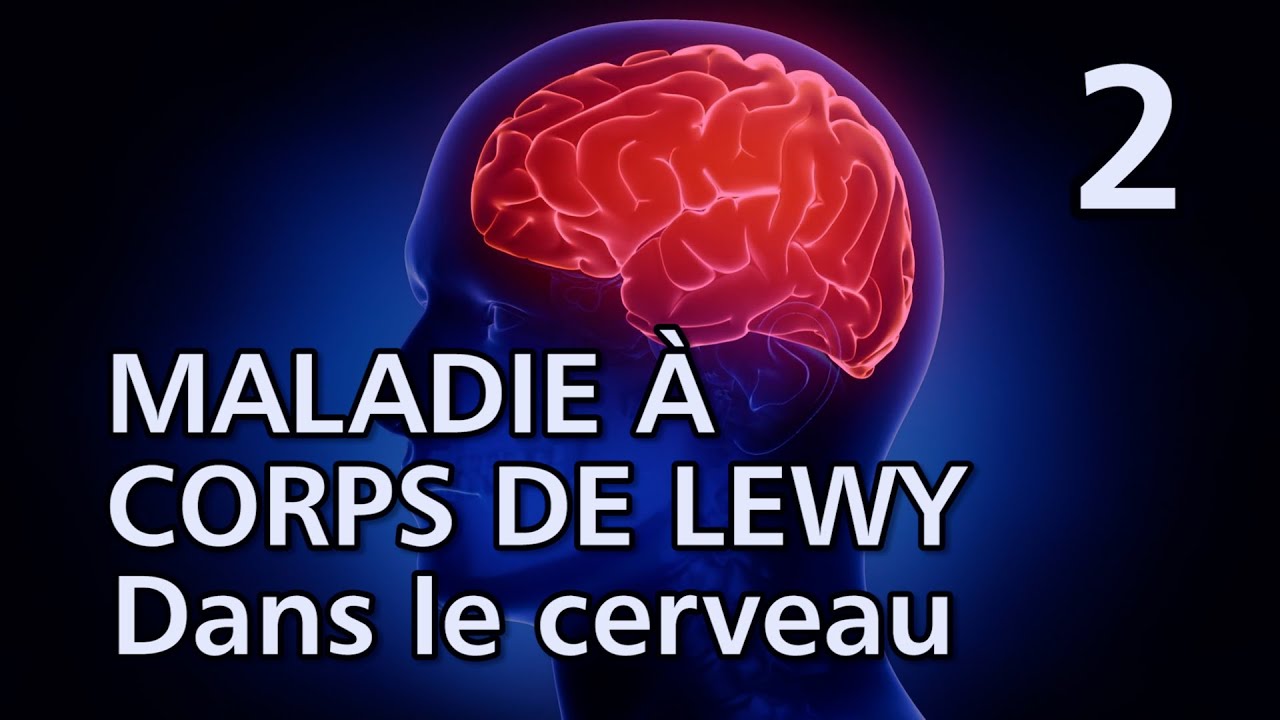 2 - Qu’est-ce qui se passe dans le cerveau ? – MALADIE À CORPS DE LEWY