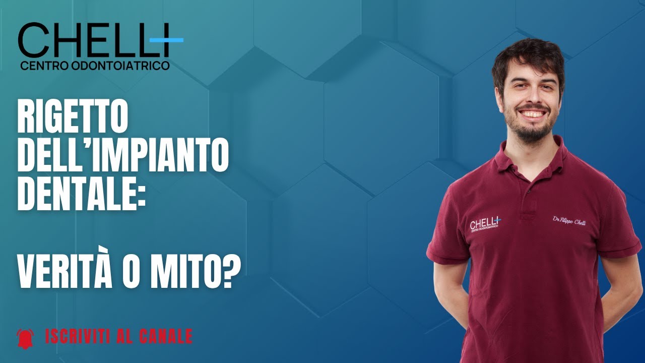 Rigetto dell’Impianto Dentale: Verità o Mito?