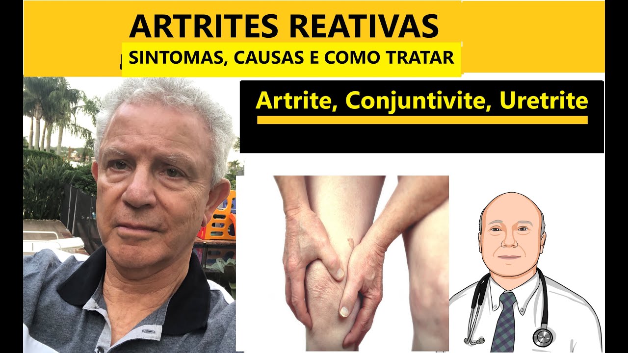 Que tipo de reumatismo são as ARTRITES REATIVAS, frequentes em homens jovens? Também nas mulheres?
