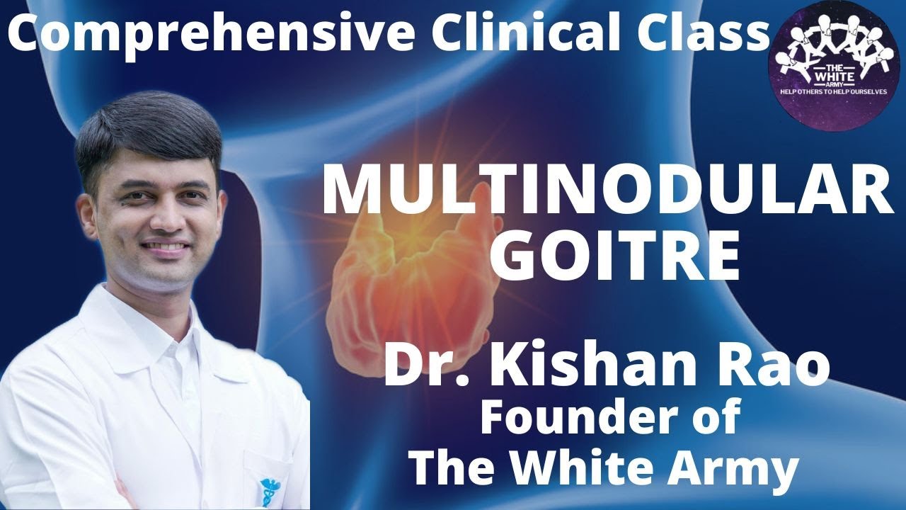MULTINODULAR GOITRE Case Presentation