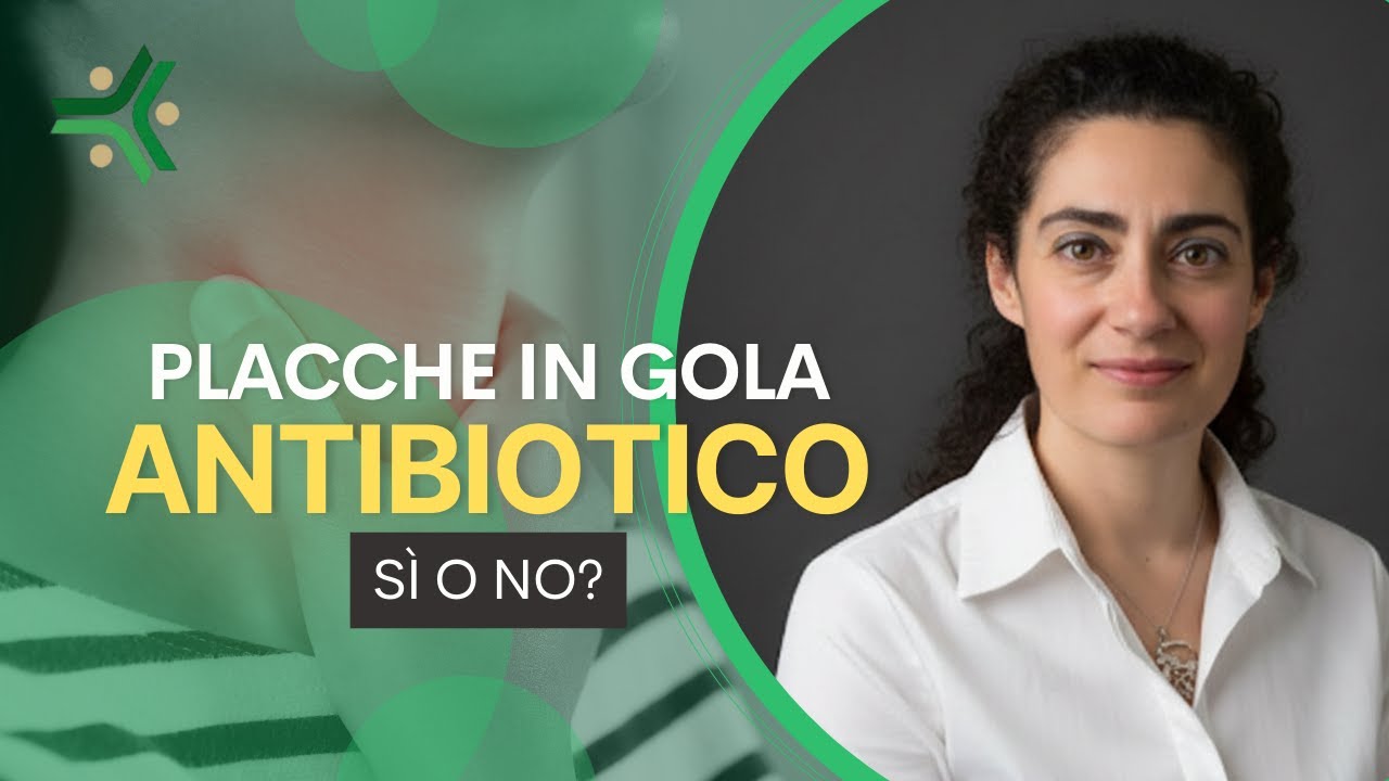 Placche in gola: prendo o non prendo l'antibiotico?