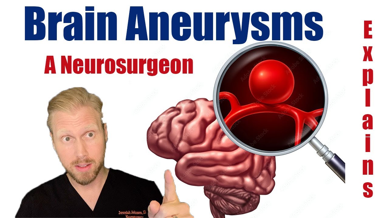 Brain Aneurysms Explained by a Neurosurgeon // Causes, Signs, Symptoms and Risk of Bleeding