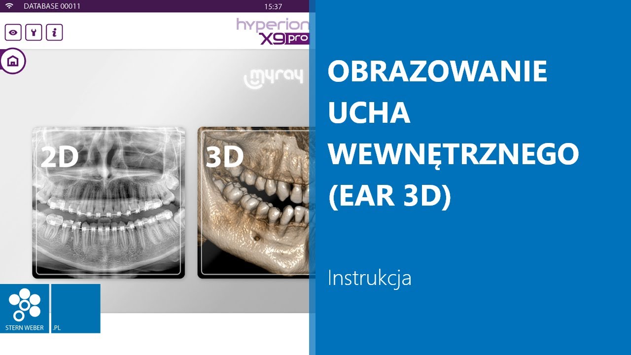 Obrazowanie ucha wewnętrznego (EAR 3D) | Instrukcja wykonywania badania w MyRay Hyperion X9