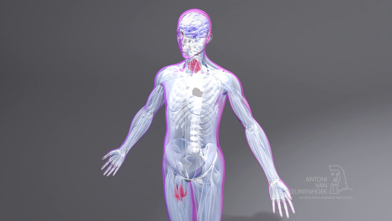 TIL Therapie