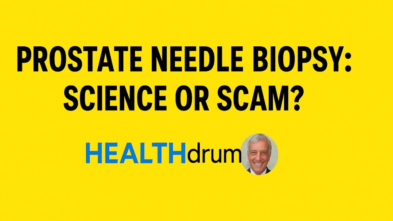 Prostate needle biopsy : Prostate cancer : Prostate biopsy