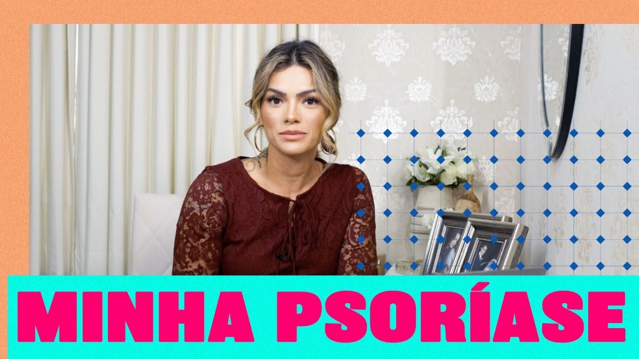 TUDO SOBRE MINHA PSORÍASE | FECHA COMIGO