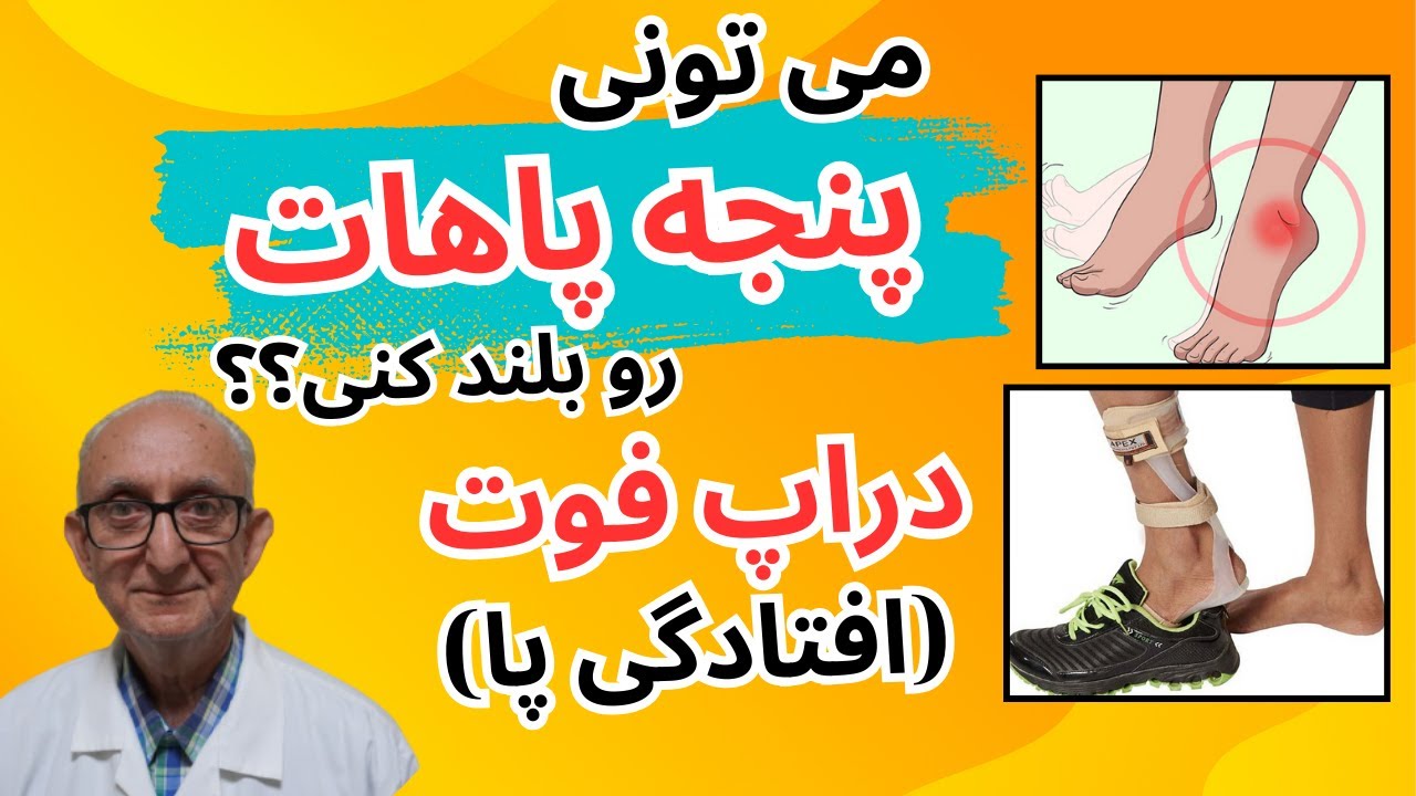 افتادگی مچ پا | درمان افتادگی مچ پا | دراپ فوت چیست؟ | افتادگی پا