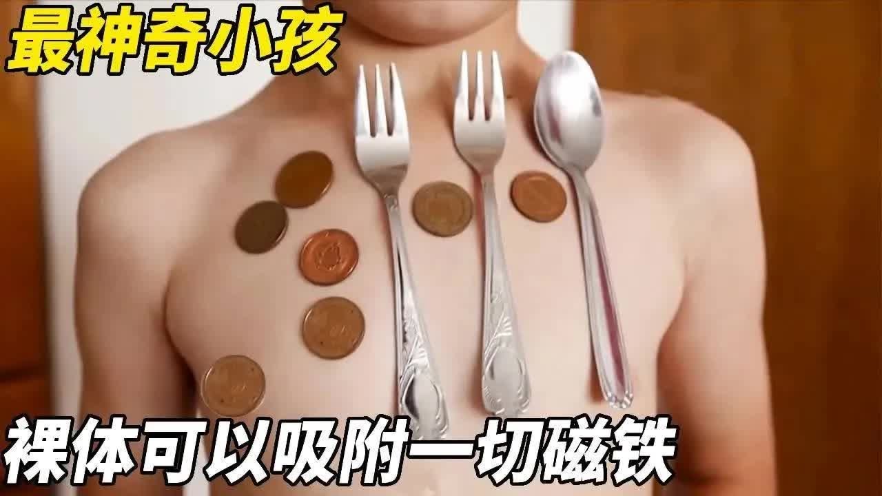 小男孩天生吸铁石圣体，身体可以吸附一切磁铁物品，医生检查后啧啧称奇！【悦贝电影】