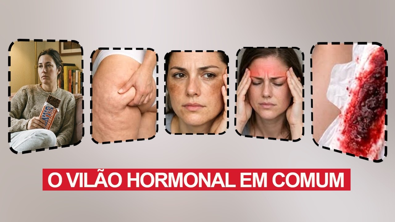 TPM, Celulite, Melasma, Sangramento e Enxaqueca