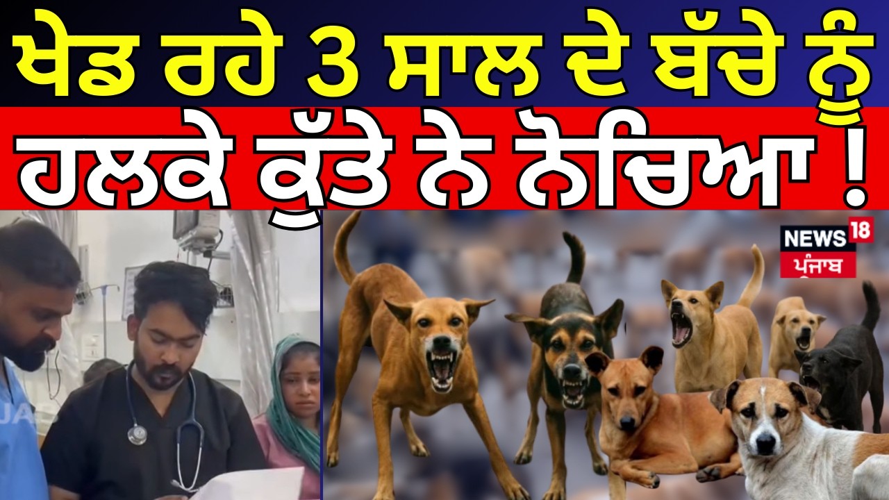Gurdaspur News | ਖੇਡ ਰਹੇ 3 ਸਾਲ ਦੇ ਬੱਚੇ ਨੂੰ ਹਲਕੇ ਕੁੱਤੇ ਨੇ ਨੋਚਿਆ! Stray dogs | Latest News | N18V