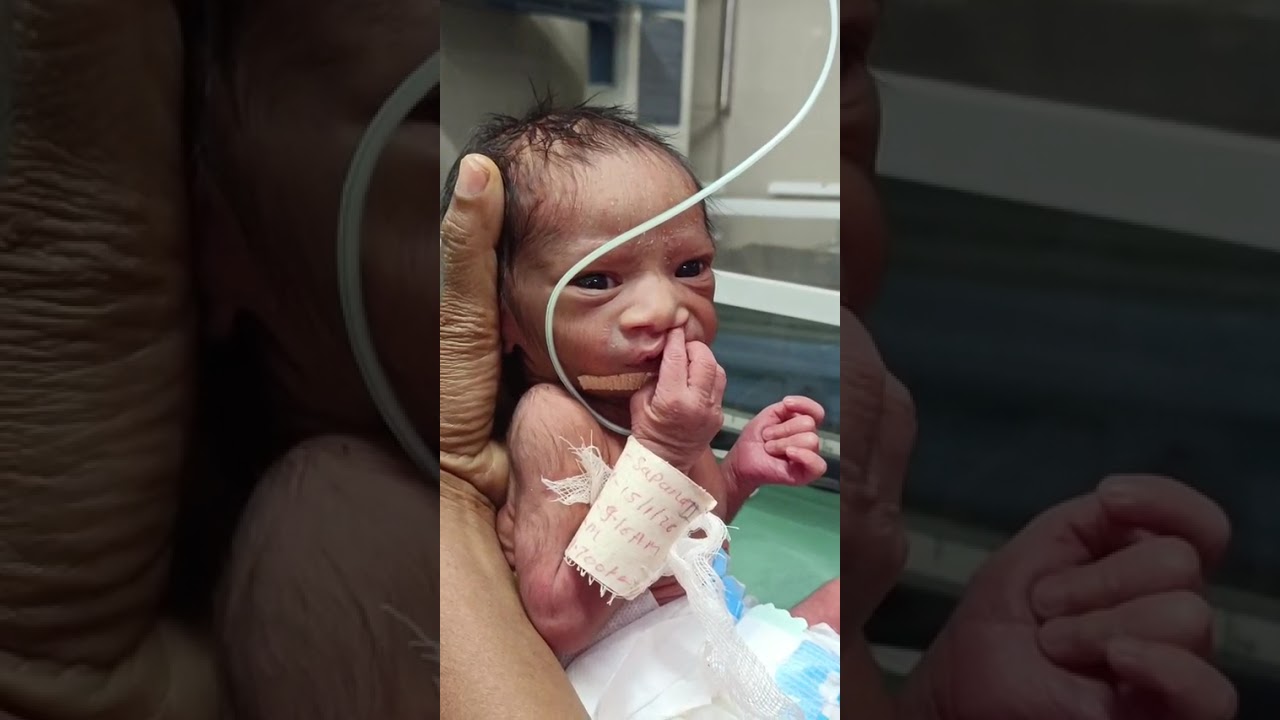 tube feeding 
