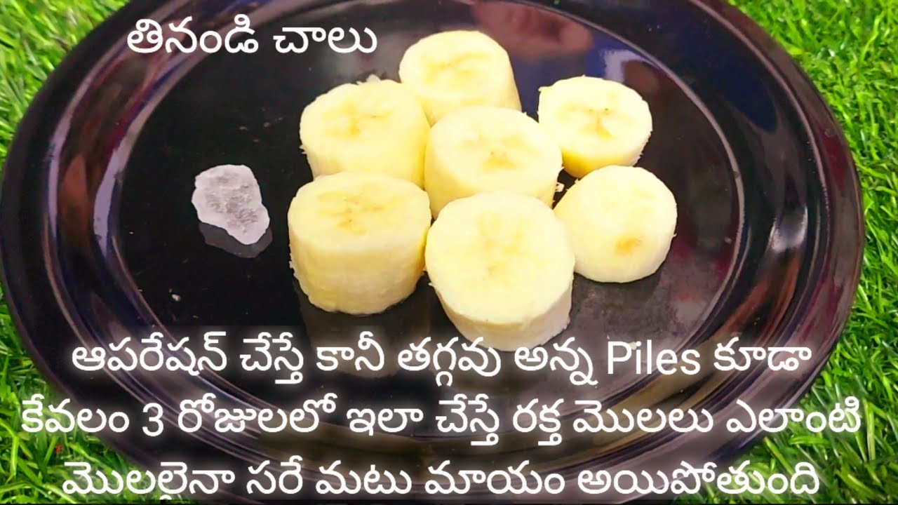 కేవలం 3 రోజులలో ఇలా చేస్తే రక్త మొలలు piles ఎలాంటి మొలలైనా సరే మటుమాయం అయిపోతుంది మళ్ళీరమ్మన్నారావు