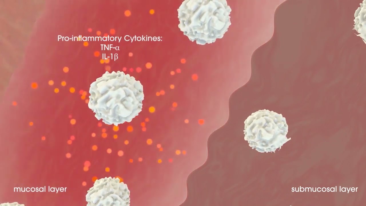 iNova Difflam Benzydamine MOA video