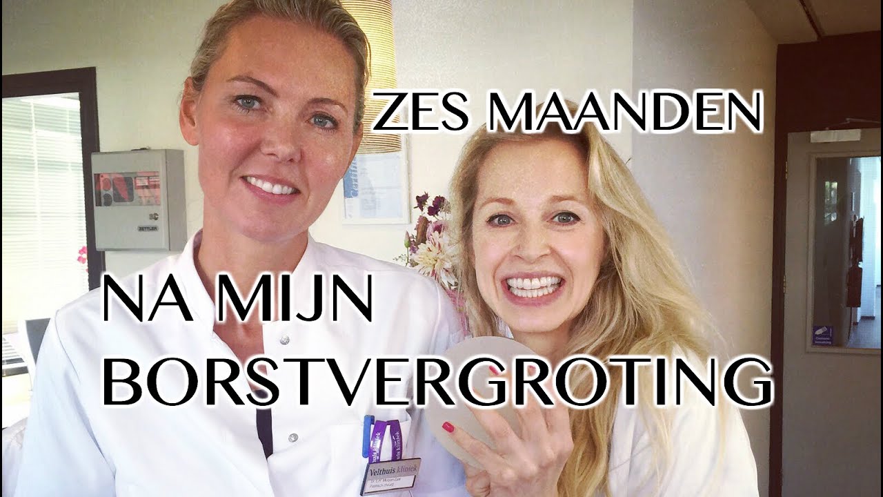 Zes maanden na mijn borstvergroting | Furrow.nl