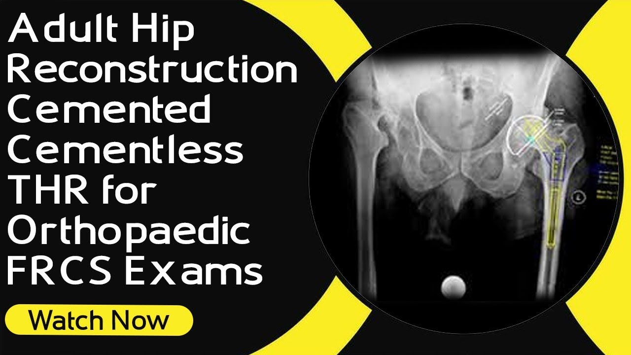 Adult Hip Reconstruction | Cemented / Cementless THR  for Orthopaedic FRCS Exams